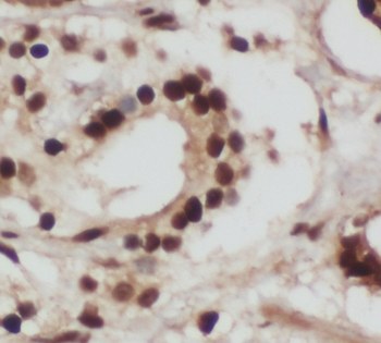 RTN4 Rabbit Polyclonal Antibody