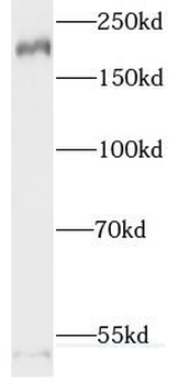 RTN4 Rabbit Polyclonal Antibody