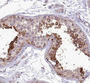 RTN4 Rabbit Polyclonal Antibody