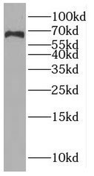 RUNDC3A Rabbit Polyclonal Antibody