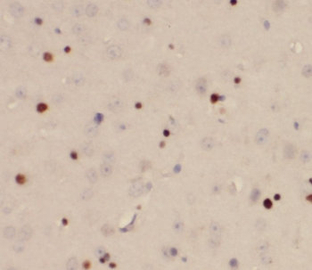 RUNX1T1 Antibody