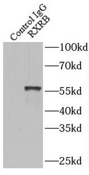RXRB Antibody