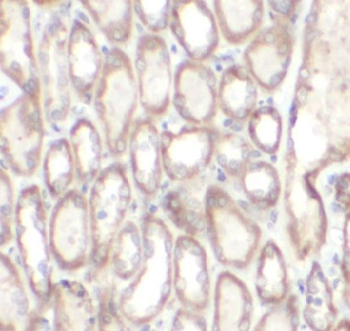 RYK Antibody