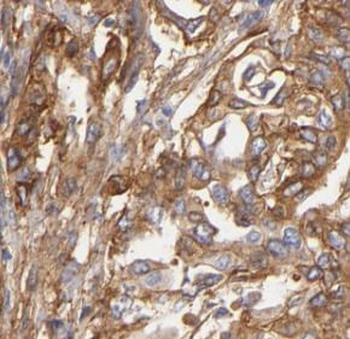 S100A10 Mouse Monoclonal Antibody