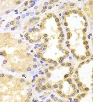 S100A11 Antibody