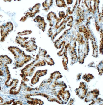 S100A13 Antibody