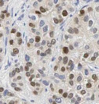 S100A4 Antibody