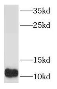 S100A5 Rabbit Polyclonal Antibody