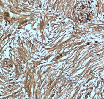 S100A5 Rabbit Polyclonal Antibody