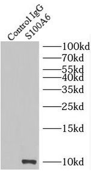 S100A6 Antibody