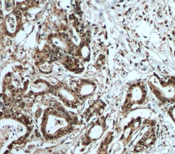S100A6 Antibody