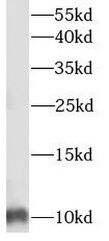 S100A6 Mouse Monoclonal Antibody