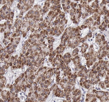 S100A6 Mouse Monoclonal Antibody