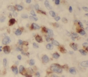 S100A8 Antibody