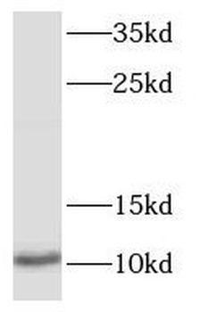 S100P Antibody