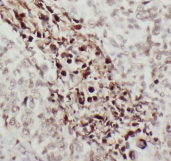 S100P Antibody