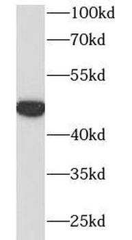 S1PR1 Rabbit Polyclonal Antibody
