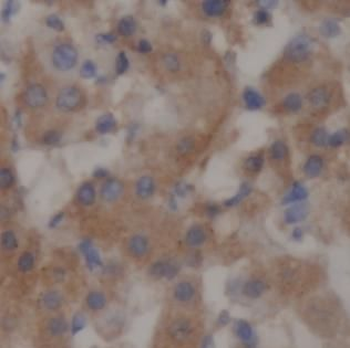 SAA1 Antibody