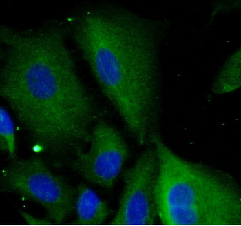 SAA2 Antibody