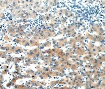 SAA2 Antibody