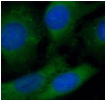 SACM1L Antibody