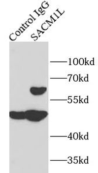 SACM1L Antibody