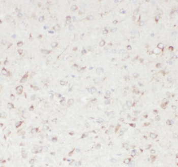 SACM1L Antibody