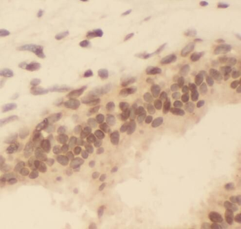 SAFB Antibody
