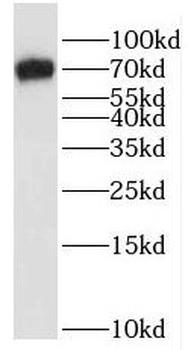 SALL4 Rabbit Polyclonal Antibody