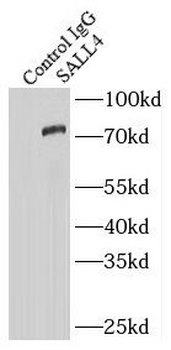 SALL4 Antibody