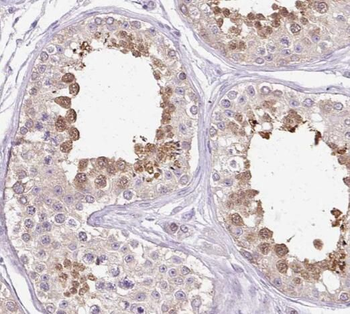 SALL4 Antibody