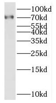 SAMD11 Antibody