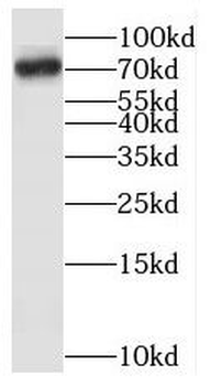 SAMD4A Antibody