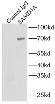 SAMD4A Antibody
