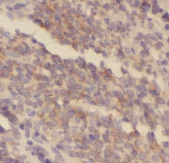 SAMD4A Antibody