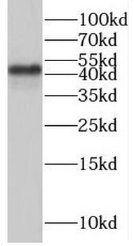 SAMSN1 Antibody