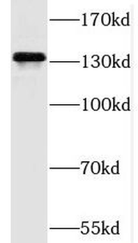PPP6R3 Rabbit Polyclonal Antibody