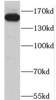 ZFYVE9 Antibody
