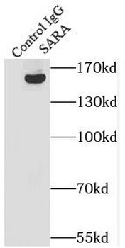 ZFYVE9 Antibody