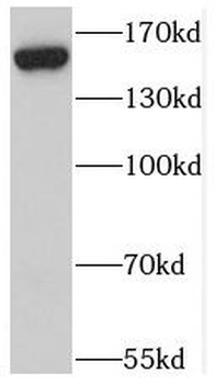 ZFYVE9 Antibody