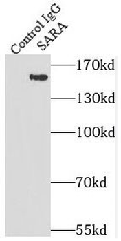 ZFYVE9 Antibody