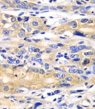 SARS1 Antibody
