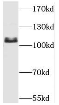 SART1 Antibody