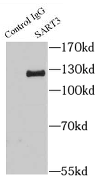 SART3 Antibody