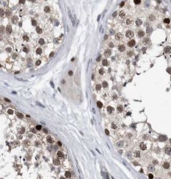 SART3 Antibody