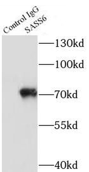 SASS6 Antibody