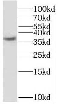 SCAMP1 Antibody
