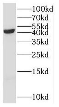 SCCPDH Antibody