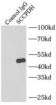 SCCPDH Antibody