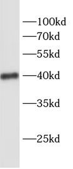 SCD Antibody